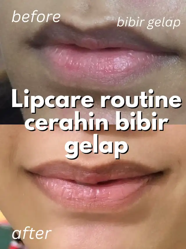 Lip Care Affordable untuk Bibir Gelap